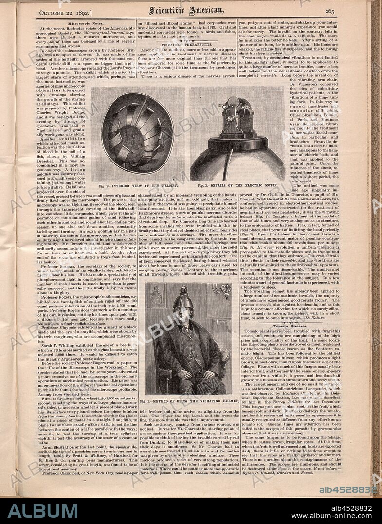 Vibration helmet according to Prof. Jean-Martin Charcot, Fig. 1-3, p. 265, 1892, Scientific American. Ser. 2, Jg. 67. New York: Scientific American, 1892.