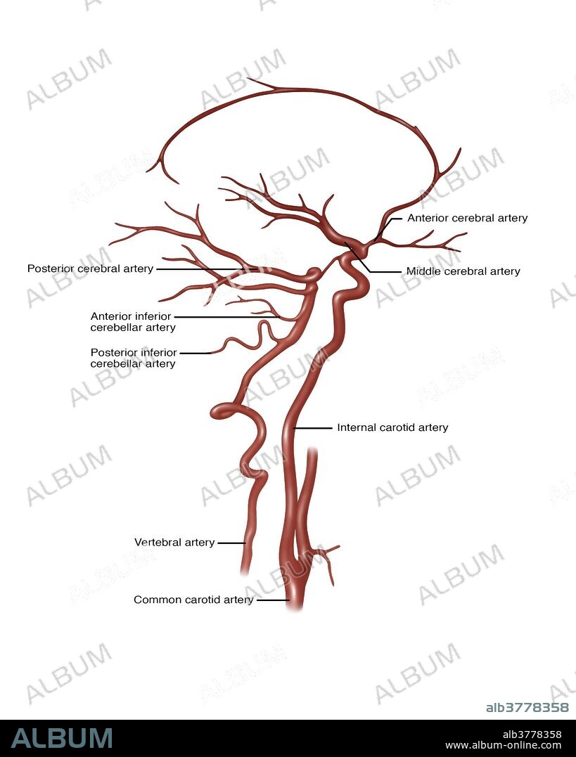 Illustration showing arteries in the head. Noted at right are anterior cerebral artery, middle cerebral artery, internal carotid artery, and common carotid artery. Labeled at left is posterior cerebral artery, anterior inferior cerebellar artery, posterior inferior cerebellar artery, and the vertebral artery.