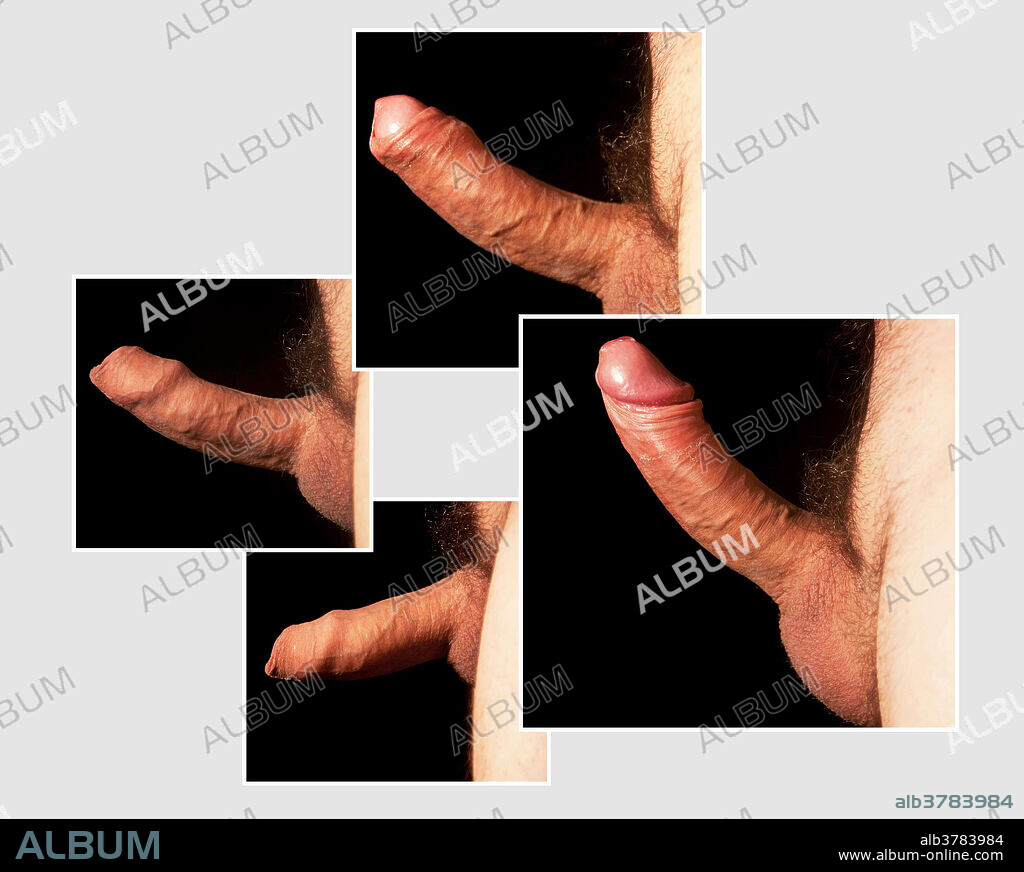 Image sequence of uncircumcised penis becoming erect. Note how the foreskin rolls back to reveal the glans.