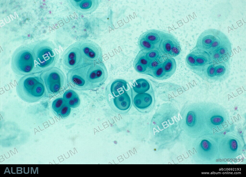 Gloeocapsa algae. Light micrograph of a living colony of Gloeocapsa sp., a type of blue-green algae (cyanobacteria). They reproduce solely by fission, a form of asexual division in which two identical algae are produced. Some of the algae at far left are dividing this way. Differential interference contrast. Magnification: x125 at 35mm size.
