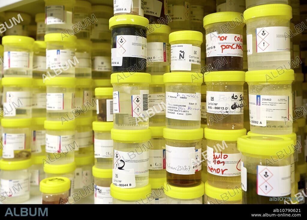 Sample storage, Anatomic Pathology, Hospital Donostia, San Sebastian, Gipuzkoa, Basque Country, Spain.
