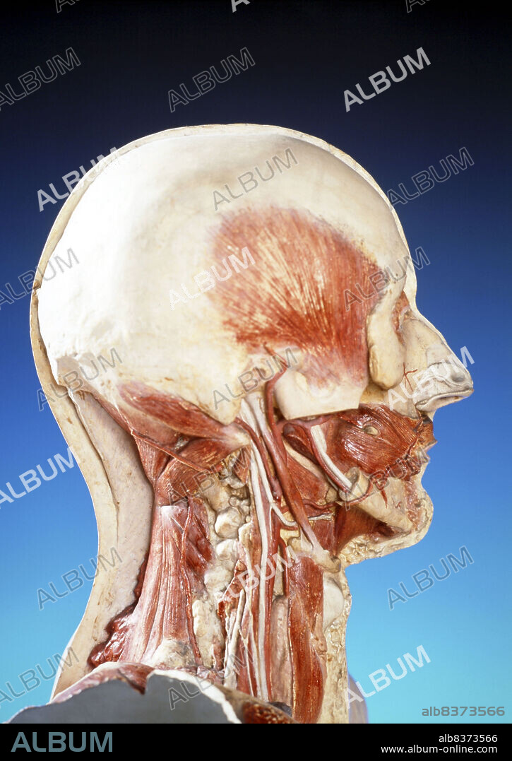 Cast of a lateral dissection of the neck, the maxillo-pharyngeal space and the nape of the neck. Deep cervical arteries.. Copies of castings done by A. Nicolas. The originals are at the Paris Museum of Medicine.