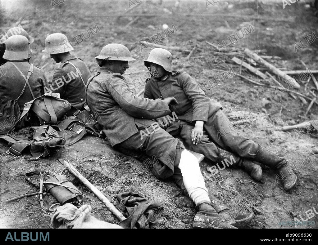Battle of Pilckem Ridge. British and German wounded talking together.