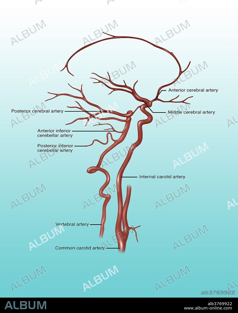 Illustration showing arteries in the head. Noted at right are anterior cerebral artery, middle cerebral artery, internal carotid artery, and common carotid artery. Labeled at left is posterior cerebral artery, anterior inferior cerebellar artery, posterior inferior cerebellar artery, and the vertebral artery.