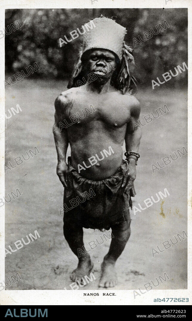 'Nanos race' : africain nain. Photographie anonyme pour une carte postale vers 1910. Credit : Collection IM/KHARBINE-TAPABOR.