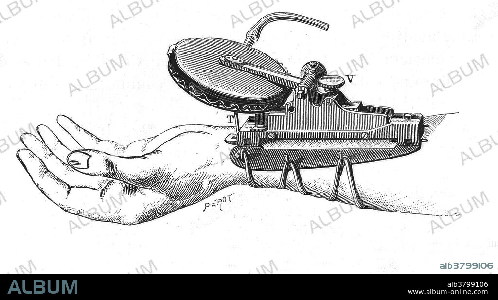 Marey's Sphygmograph, 1861