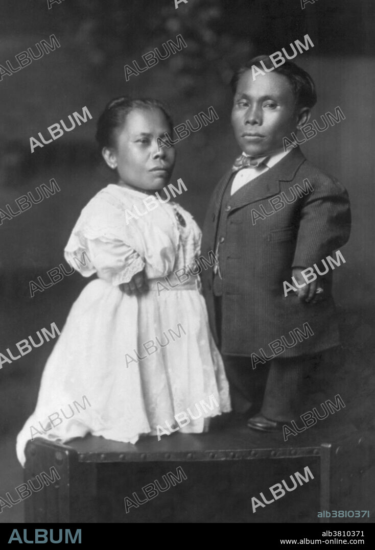 Dwarf Filipino Couple. Dwarfism, also known as short stature, occurs when an organism is extremely small. In humans, it is sometimes defined as an adult height of less than 4 feet 10 inches, regardless of sex, although some individuals with dwarfism are slightly taller. Disproportionate dwarfism is characterized by either short limbs or a short torso. In cases of proportionate dwarfism, both the limbs and torso are unusually small. Photographed by Gerhard Sisters, 1914.