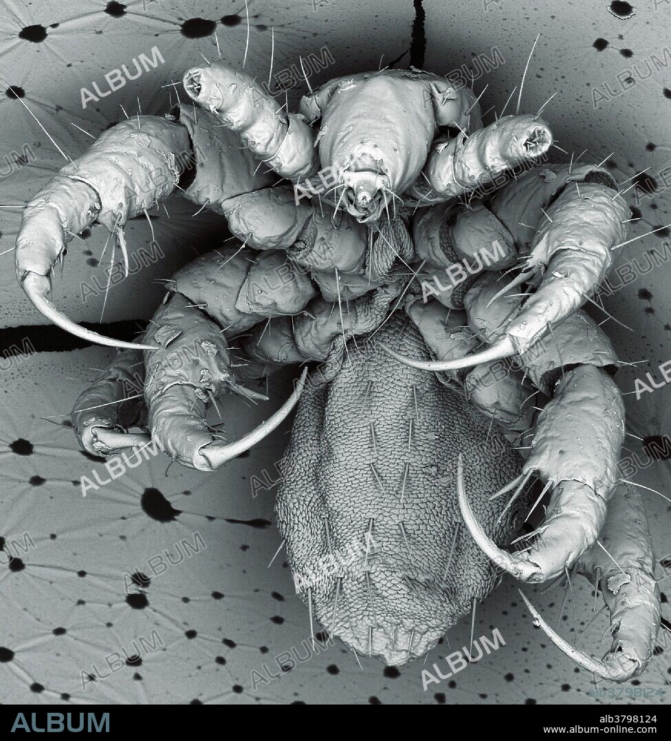 Scanning electron micrograph of a head louse. Head lice (Pediculus) feed on human blood and live in close proximity to the scalp. They lay eggs (nits) in sacs which firmly attach to individual strands of hair near the base of the shaft. Width of image is 900 micrometres. Supplied by Kevin Mackenzie, courtesy of Wellcome Images.