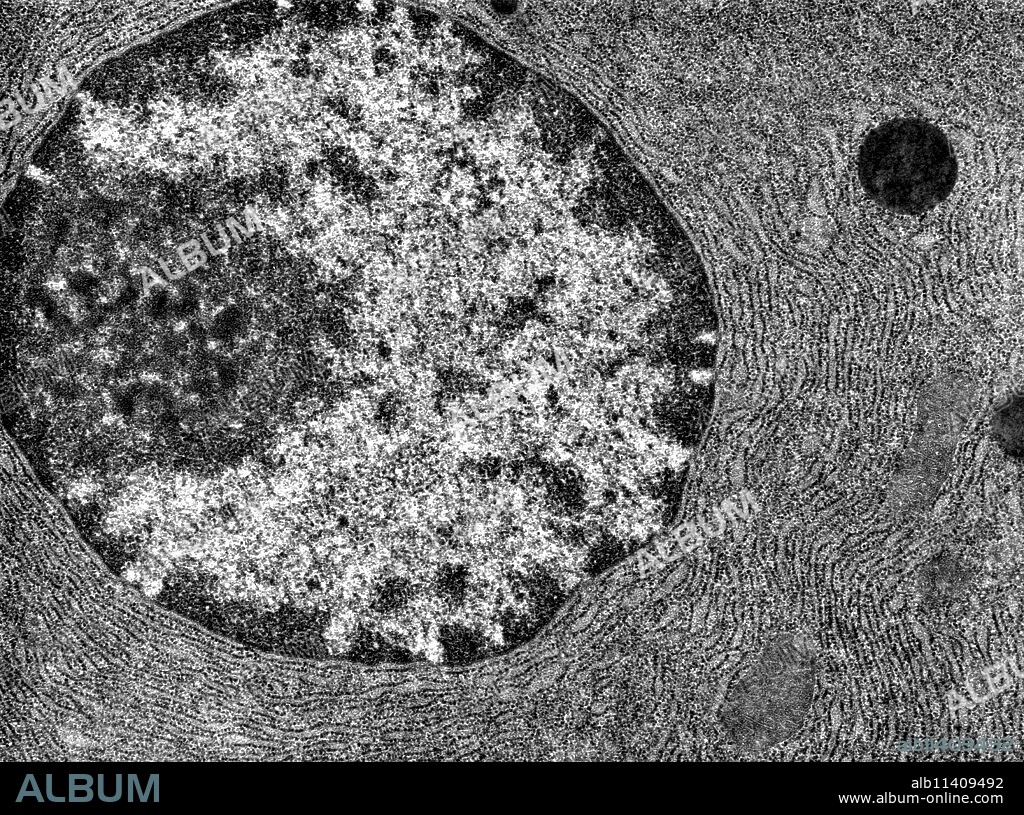 Transmission electron microscope (TEM) micrograph showing a cell with a nucleus (right) that contain a dense peripheral heterochromatin and a prominent nucleolus. The cytoplasm is full of RER. x10,000.