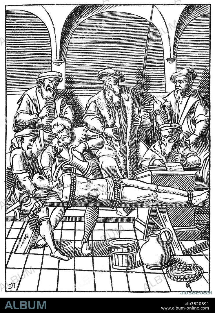 Water torture is a form of torture in which the victim is forced to drink large quantities of water in a short time, resulting in gastric distention, water intoxication, and possibly death. Often the victim has the mouth forced or wedged open, the nose closed with pincers and a funnel or strip of cloth forced down the throat. The victim has to drink all the water (or other liquids such as bile or urine) poured into the funnel to avoid drowning. The stomach fills until near bursting and is sometimes beaten until the victim vomits and the torture begins again. Water torture was used extensively and legally by the courts of France from the Middle Ages to the 17th and 18th centuries. It was known as being put to "the question", with the ordinary question involving the forcing of one gallon of water into the stomach and the extraordinary question involving the forcing of two gallons. Woodcut dated 1556.