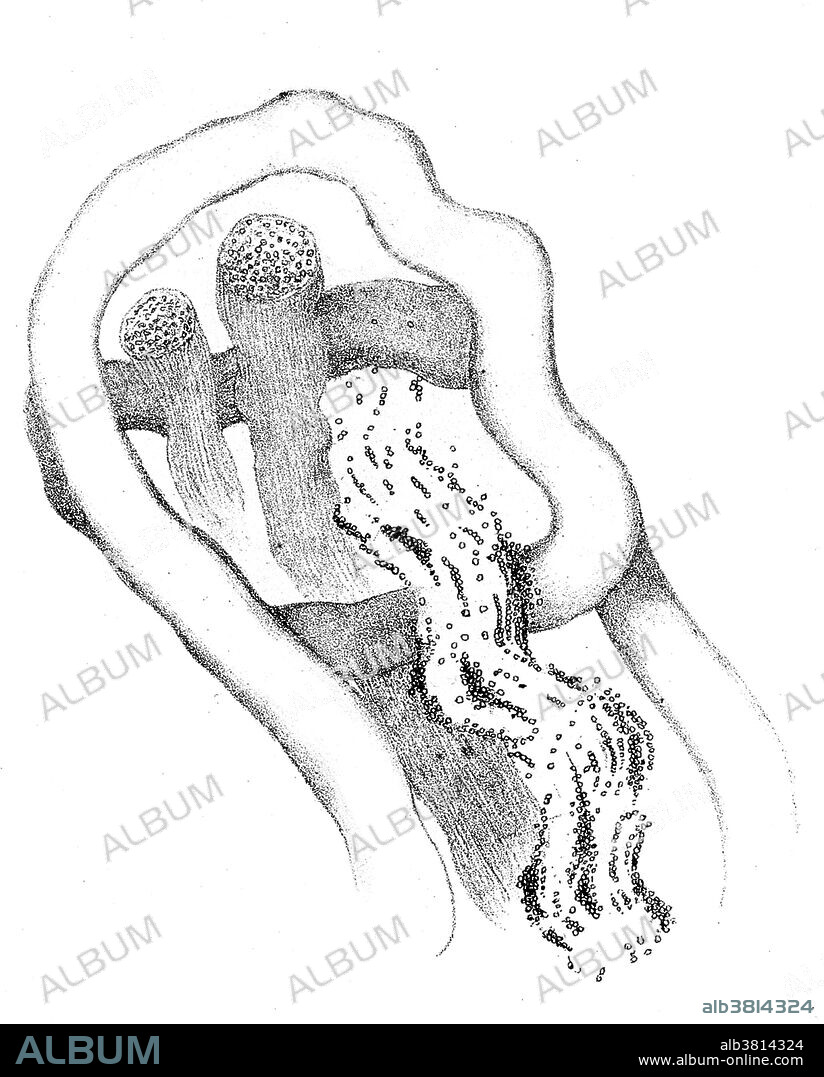 Wallerian Degeneration of Nerve, Waller, 1850