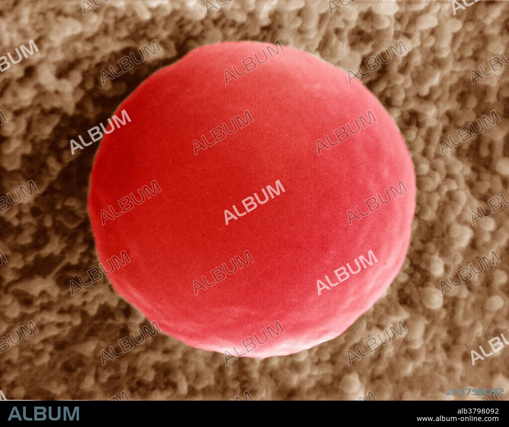 A red blood cell in a hypotonic solution showing a spherical shape as a result. Magnification 15,000x at 8" x 10". Enhancement of 9L6767.
