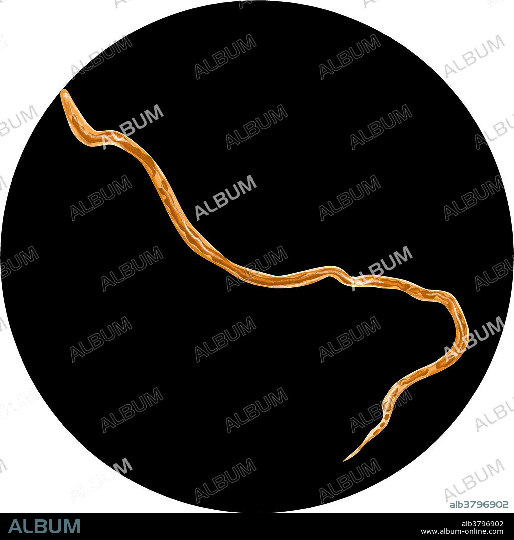 Adult Onchocerca Volvulus