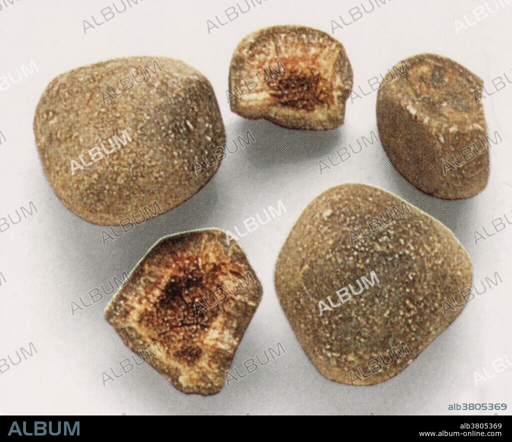 Bezoar Stones. These natural rocklike objects form in the stomachs of animals, such as goats, sheep, and cows, and were once said to have magical powers against disease. Human stones from the bladder, kidney, and gall bladder were similarly prized. A bezoar is a mass found trapped in the gastrointestinal system, though it can occur in other locations. Bezoars were sought because they were believed to have the power of a universal antidote against any poison. It was believed that a drinking glass which contained a bezoar would neutralize any poison poured into it. The word bezoar comes from the Persian pad-zahr, which literally means "antidote". The Andalusian physician Ibn Zuhr, known in the West as Avenzoar, is thought to have made the earliest description of bezoar stones as medicinal items. In 1575, the surgeon Ambroise ParÃ© proved that the bezoar stone could not cure all poisons as was commonly believed at the time.
