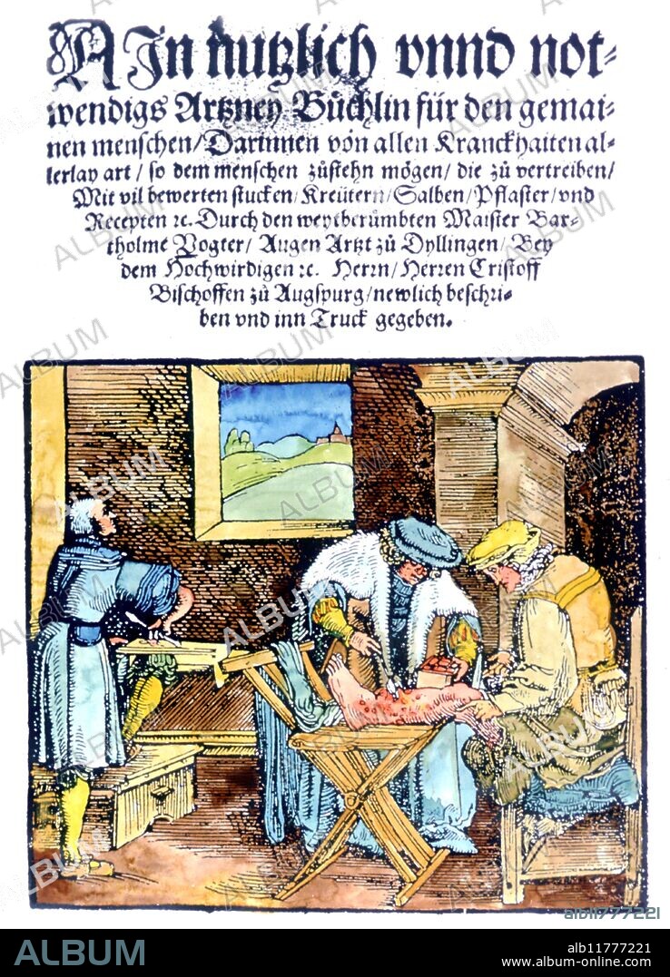 Medical Operation. Doctor operating on the leg of a man. From the titlepape of Bartholomaus Vogter's Ein nutzlich unnd notwendigs Artzney Buchlin fur den gemainene menschen Augsburg 1531.