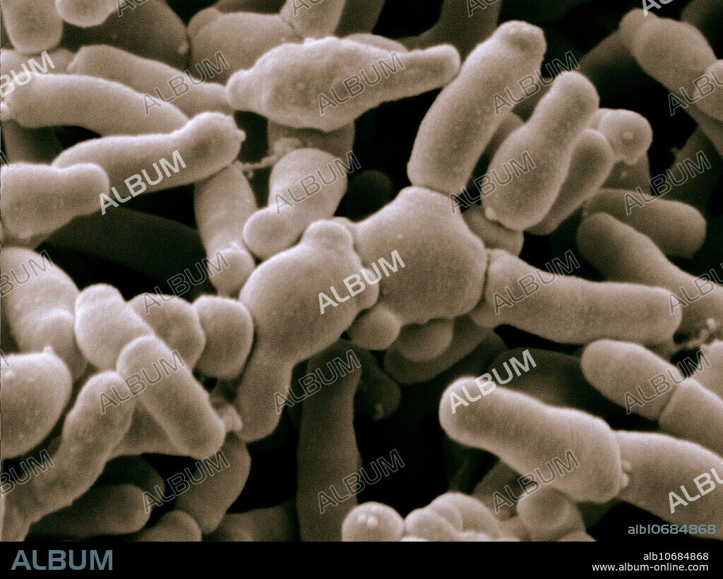 Bifidobacterium Breve Bacteria, under a microscope (SEM)