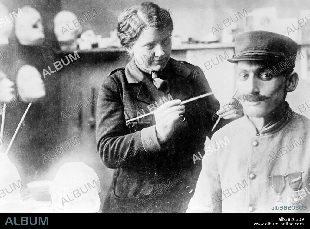 Entitled: "When Mrs. Ladd has completed the molded resemblance a copper reproduction is made, which is first silvered and coated with enamel, and finally painted in flesh colors." Photograph of Anna Coleman Ladd in her studio painting a mask worn by a French soldier who was disfigured in WWI. Anna Coleman Watts Ladd (July 15, 1878 - June 3, 1939) was an American sculptor. In late 1917 she travelled to Paris and founded the American Red Cross "Studio for Portrait-Masks" to provide cosmetic masks to be worn by men who had been badly disfigured in World War I. Soldiers would come to Ladd's studio to have a cast made of their face and their features sculpted onto clay or plasticine. This form was then used to construct the prosthetic piece from extremely thin galvanized copper. The metal was painted to resemble the recipient's skin. Her services earned her the LÃ©gion d'Honneur Crois de Chevalier and the Serbian Order of Saint Sava. In 1936, Ladd retired with her husband to California, where she died in 1939 at the age of 60.