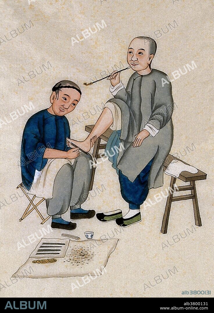 A foot doctor at work: the male patient is seated on a bench and smoking a pipe. Massage in Traditional Chinese Medicine is known as An Mo (pressing and rubbing) or Qigong Massage, and is the foundation of Japan's Anma. Categories include Pu Tong An Mo (general massage), Tui Na An Mo (pushing and grasping massage), Dian Xue An Mo (cavity pressing massage), and Qi An Mo (energy massage). Tui na focuses on pushing, stretching, and kneading muscles, and Zhi Ya focuses on pinching and pressing at acupressure points. Technique such as friction and vibration are used as well. The Chinese foot massage has been practiced for centuries and is a popular pastime in China. The process consists of a foot bath followed by an intense massage on various pressure points in the feet, ankles, and legs. For many Westerners, a traditional Chinese massage can be painful the first time. The ancient Chinese medical text, Huangdi Neijing, has been consulted for more than two millennia. It was written by the Yellow Emperor. In the text, the emperor recommends massage for healing and health. Watercolor by Zhou Pei Qun, 1890s.