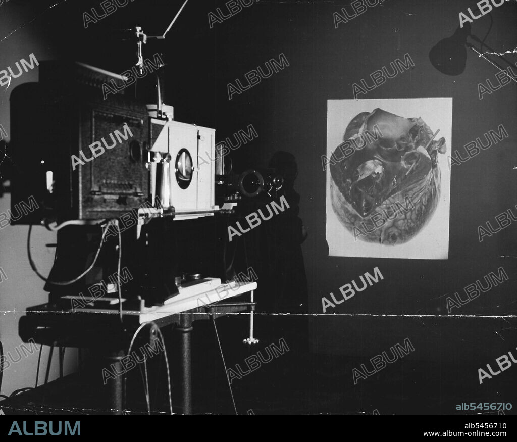 Epidiascope is used to project photographic slides or images of actual speciments on to a screen for lectures. Picture being thrown on to wall here is of a diseased human heart. April 27, 1946.