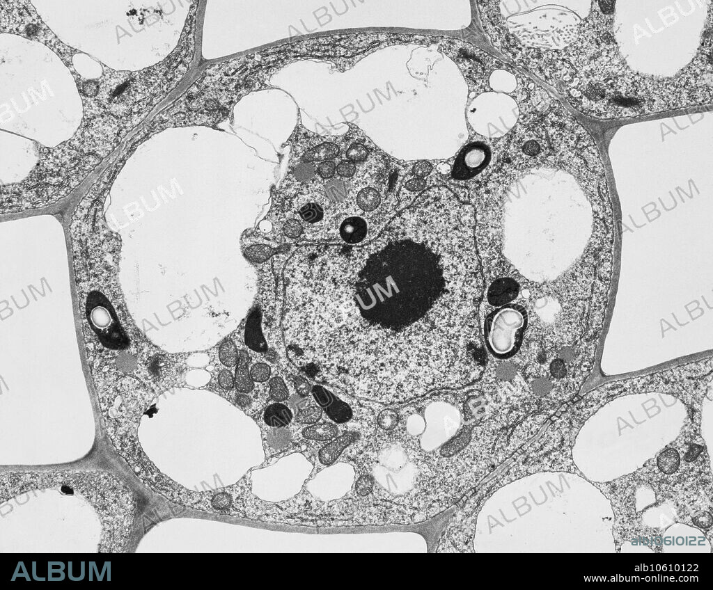 Transmission electron micrograph (TEM) of a sago pondweed (Potamogeton pectinatus) cell. At centre is the nucleus, which contains the cell's genetic information in the form of DNA (deoxyribonucleic acid, black). Also within the cell are many vacuoles (white).