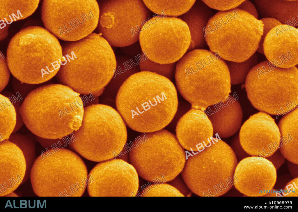 Coloured scanning electron micrograph (SEM) of Kluyveromyces lactis yeast cells. This yeast metabolises lactose (milk sugar) into lactic acid. It is used to reduce lactose concentration in milk and also as a source of lactase and other enzymes. Image width: 11.2 micrometers.