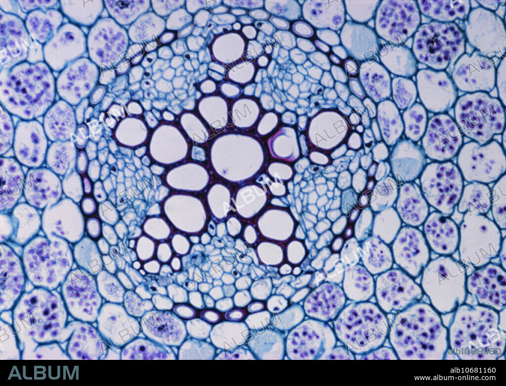 Light micrograph of dicotyledon root (Ranunculus) in transverse section.