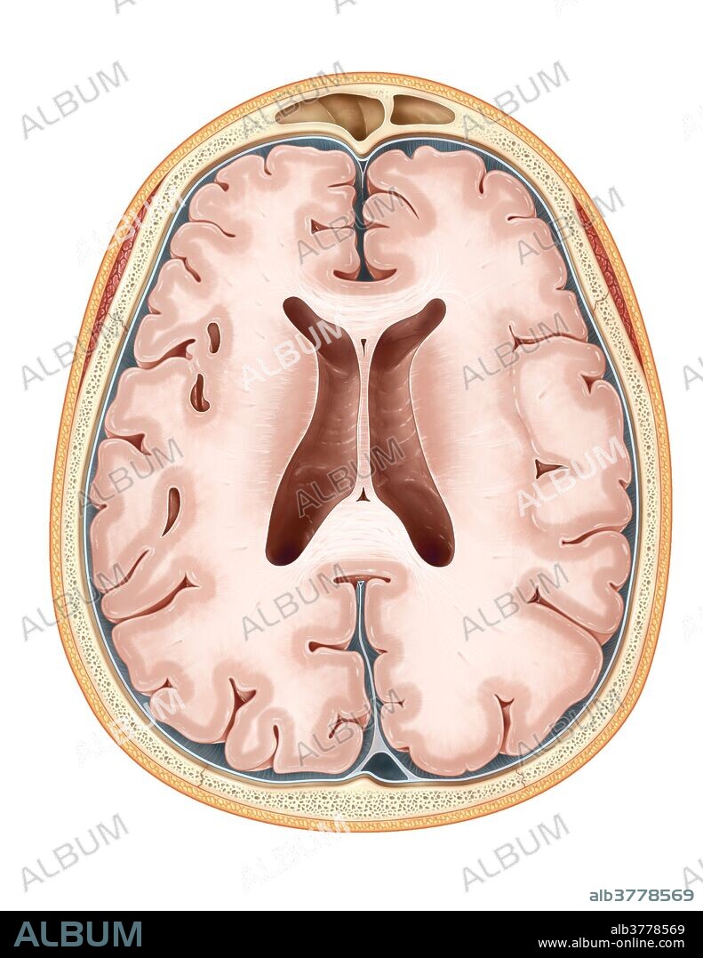 An illustrated transverse section of the brain depicting the body of the lateral ventricle, the genu and splenium of the corpus callosum, and the caudate nucleus. (The brain's the white matter is colored light beige and the grey matter of the cerebral cortex is dark beige).