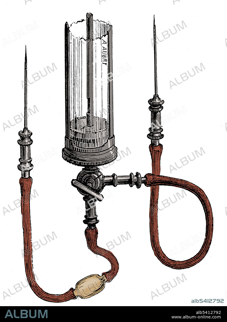 Blood Transfusion Apparatus, 1876