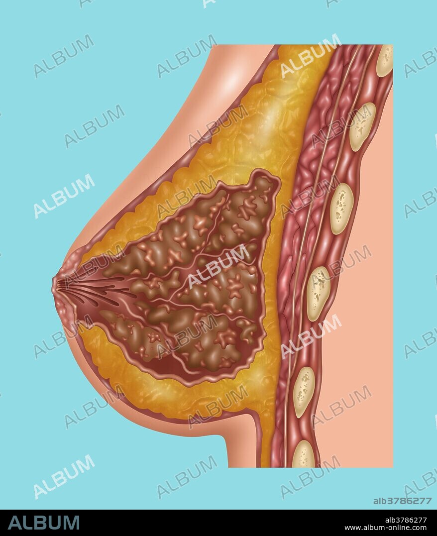 Illustration detailing the anatomy of a female breast. Depicted are the ribs (tan spots), skin (outer most layer), pectoris major muscle (red muscle tissue), adipose tissue (orange), lobe (light pink surrounding the brown area), nipple (light pink center point), opening of lactiferous duct, suspensory ligaments (light pink strands), and lobules (brown) containing alveoli (light pink clusters).