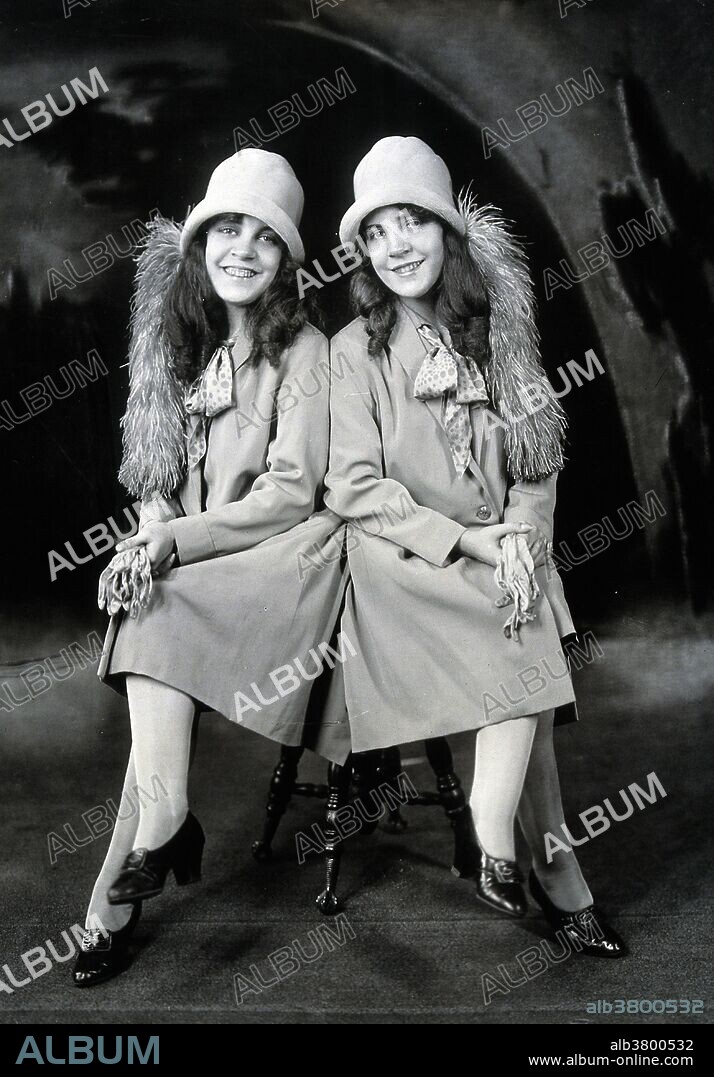 Entitled: "Daisy and Violet Hilton, conjoined twins, dressed to go out." Daisy and Violet Hilton (February 5, 1908 - January 4. 1969) were a pair of English Siamese Twins, joined by their hips and buttocks; they shared blood circulation and were fused at the pelvis but shared no major organs. Their mother worked in a bar and sold the twins to her boss, who toured them around the world. They gained recognition in Germany, the US and Australia and tap danced in a Bob Hope act. They gained independence in 1931 and went into vaudeville. Violet was a saxophonist and Daisy a violinist. After vaudeville lost popularity, the sisters performed in burlesque, and struggled to make a living. Their last public appearance was in 1961 at a drive-in cinema in Charlotte, North Carolina. Their manager abandoned them there, and with no means of transportation or income, they were forced to take a job in a nearby grocery store. In 1969, after they failed to report to work, their boss called the police. The twins were found dead in their home, victims of the Hong Kong flu. According to a forensic investigation, Daisy died first; Violet died between two and four days later. They were 60 years old. Progress Studio, New York, 1927.
