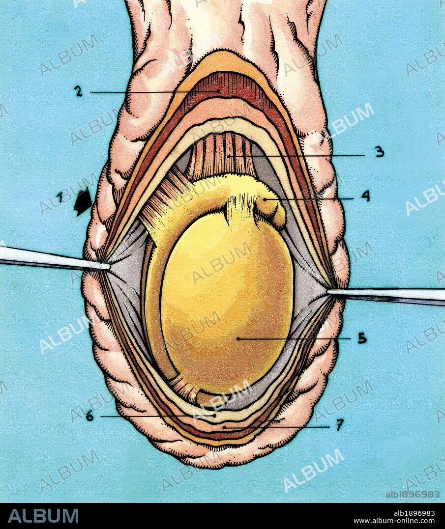 EL APARATO REPRODUCTOR. SACO ESCROTAL ABIERTO. 1. Escroto 2. Músculo cremaster 3. Cordón espermático 4. Epidídimo 5. Testículo 6. Túnica vaginal propia 7. Túnica vaginal común.