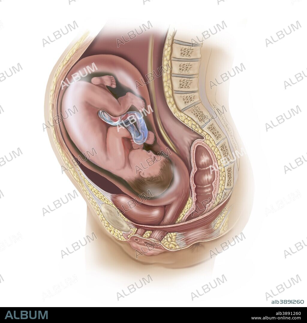 Full-term baby in uterus.