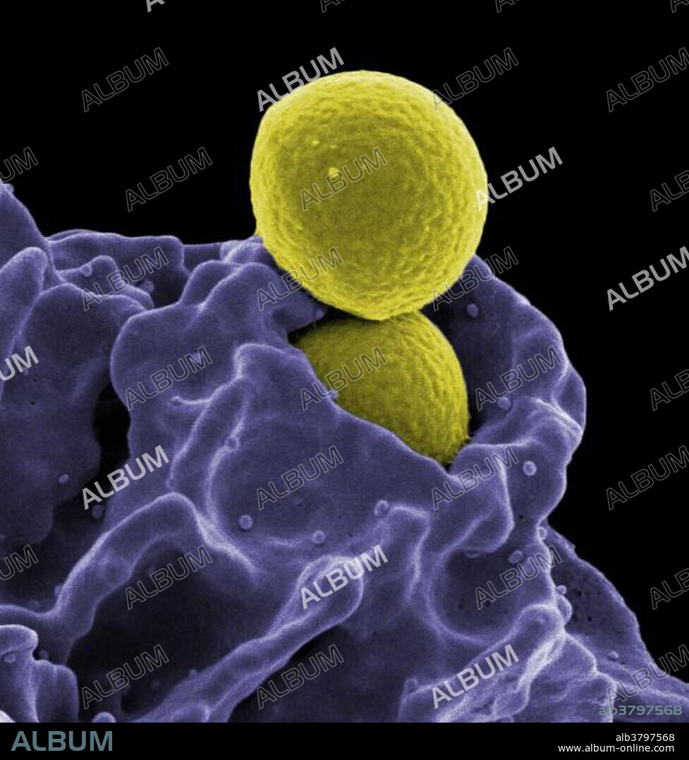 Neutrophil ingesting MRSA Bacteria, under a microscope (SEM)
