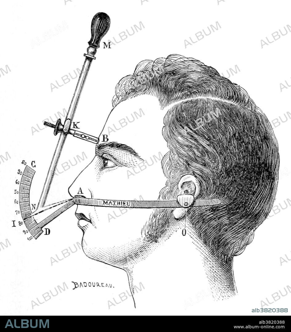 Bertillon's Anthropometry, 1883