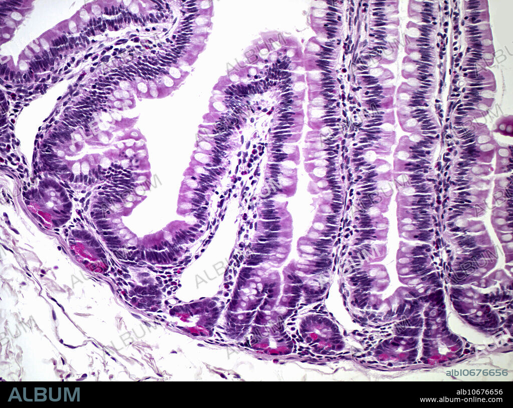 Light micrograph of the jejunum showing paneth cells. H and E stain of human tissue; magnification: 140X.