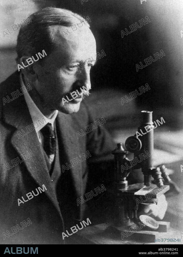 Ewing seated at microscope. James Stephen Ewing (1866-1943) was an American pathologist. He was the first Professor of pathology at Cornell University and became famous with the discovery of a form of malignant bone tumor. Ewing was active in many fronts, including hematology as well as oncology. A scientific breakthrough came in 1906, when Ewing and his collaborators proved for the first time that a cancer (lymphosarcoma in dogs) could be transmitted from one animal to another. In 1920 he published his first work on a new kind of malignant osteoma, which later received his name, Ewing's sarcoma. Ewing became known also as one of the first proponents of radiation therapy for cancer, having founded the National Radium Institute in 1913. He was responsible for the creation of present-day Memorial Sloan-Kettering Cancer Center in New York City, one of the most important multidisciplinary centers devoted to oncology in the world. He worked at the Memorial until his retirement, in 1939. He died from bladder cancer at the age of 76.