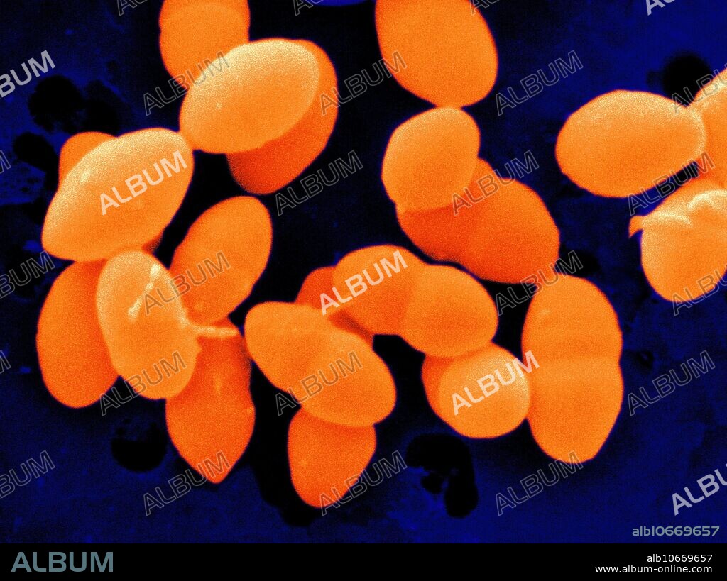 Scanning electron micrograph (SEM) of Streptococcus sanguis. Streptococcus sanguis bacteria are part of indigenous human oral microflora. They bind to oral surfaces and make it possible for other bacteria to join and form dental plaque as a kind of biofilm on dental enamel. (Microscope magnification: 26,000x, image width: 4.9 micrometers.).