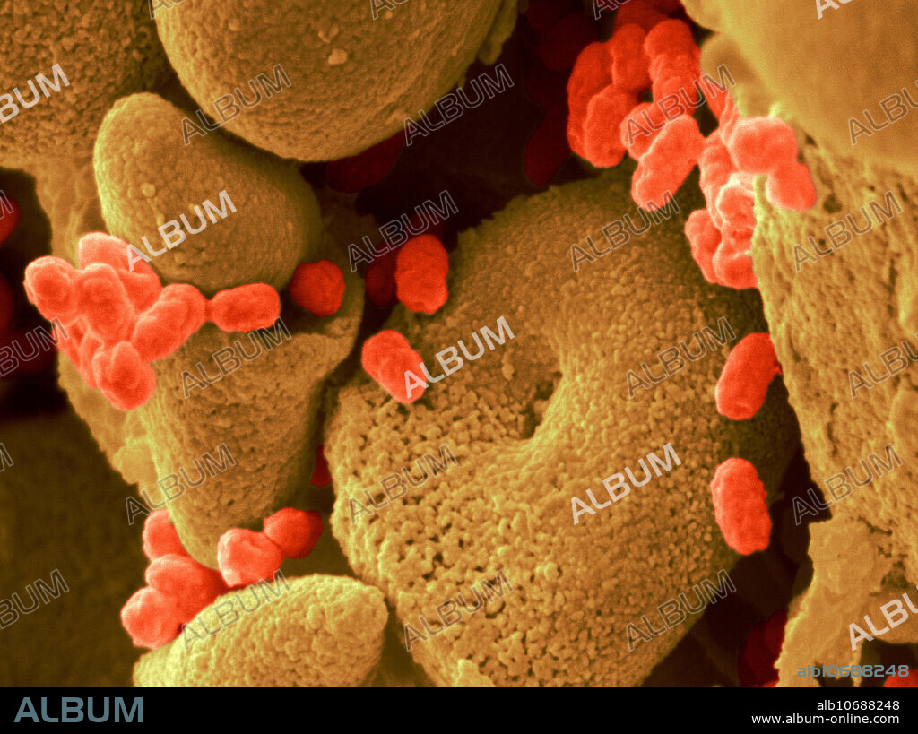 Serratia marcescens bacteria on a cracker. This is a common microbe living in the soil, water, on plants, and in animals. Because of its bright red color and because it may grow on bread and crackers stored in a damp place, it has contributed to miracles, simulating the blood of Jesus Christ on communion wafers. In a study called Operation Sea-Spray, the US Army filled balloons with S. marcescens and burst them over San Francisco in 1951 and 1952. A severe incidence of pneumonia and urinary tract infections followed shortly afterwards, and the bacterium was not considered harmless anymore. Enhanced SEM. Image width: 8.5 micrometers. Magnification: 11,765x if the image is printed 10 cm wide.