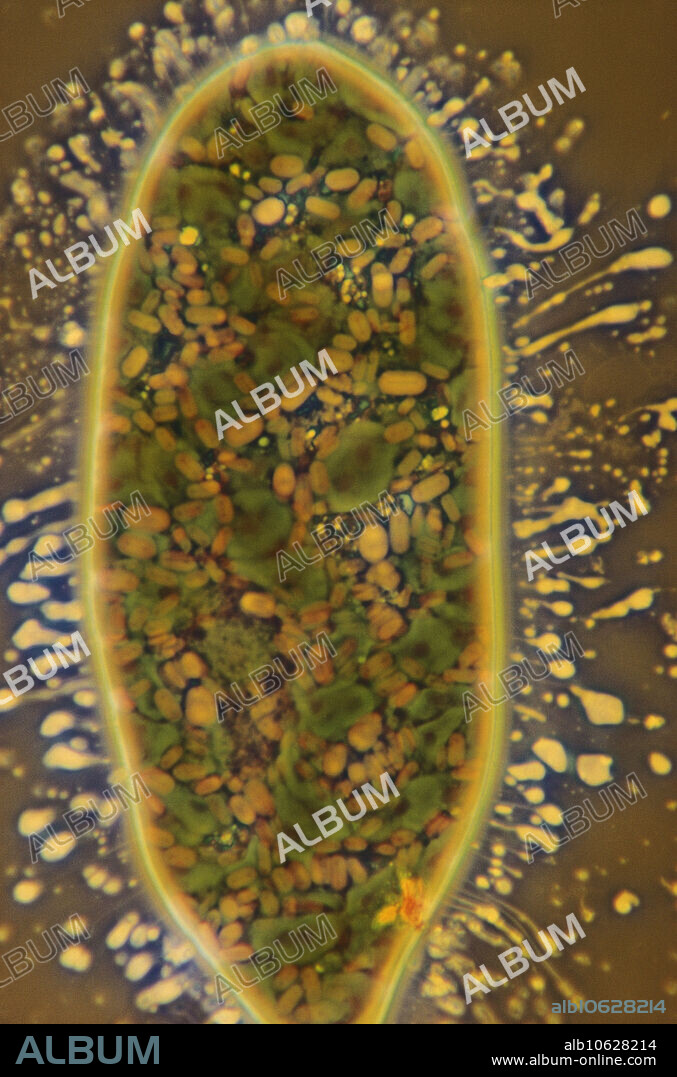 Light micrograph of Euglena spirogyra releasing mucilage. Magnification unknown.