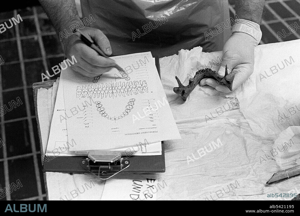 May 20, 2002; Orahovac, Kosovo; Forensic anthropologists at the morgue in Orahovac/Rahovec, Kosovo, record any useful information which might identify a body, including dental information. However, there are few dental records from Kosovo, and the Serb army destroyed most such records. The war crimes trial of three former members of the Kosovo Liberation Army started at the UN Yugoslav tribunal on November 23, 2004, marking the first time ethnic Albanians face charges stemming from the Kosovo war. (Credit Image: © David I. Gross/ZUMAPRESS.com).
