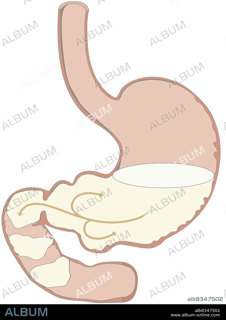 This image shows the alimentary bolus in the stomach and going through the duodenum.