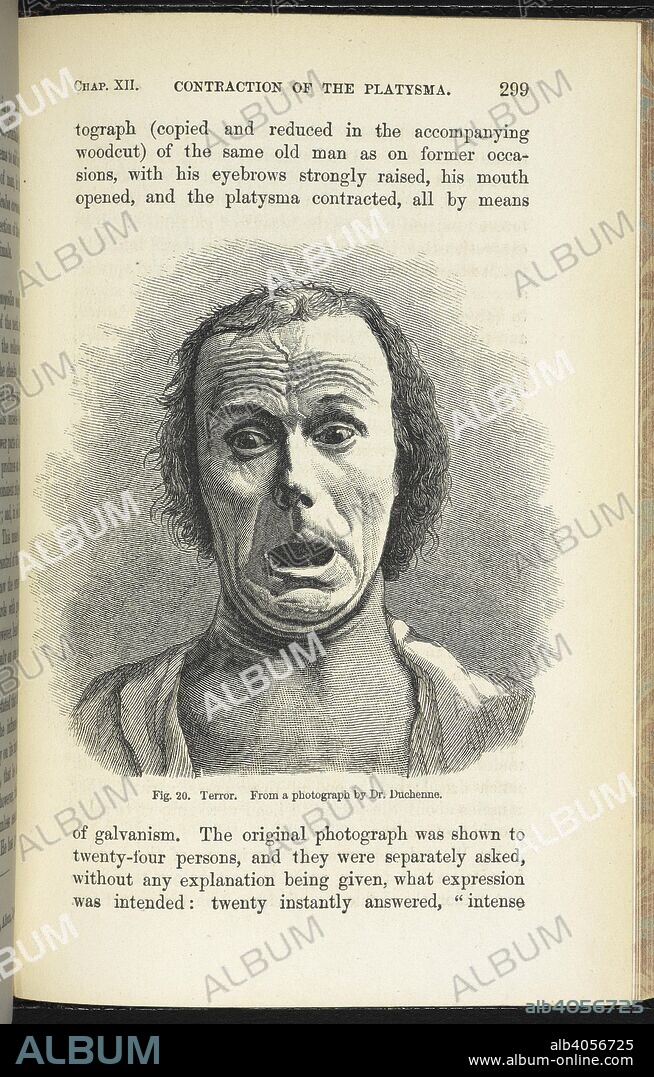 CHARLES DARWIN. Terror. From a photograph by Dr. Duchenne, in 'Expression of the Emotions in Man and Animals'. Expression of the Emotions in Man and Animals. London, 1873. Source: 7005.df.6, page 299.