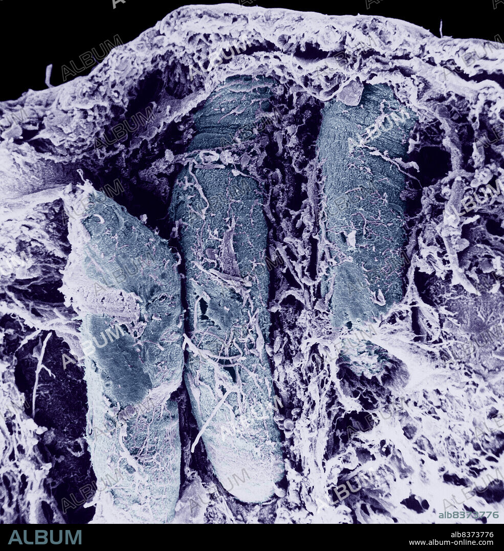 Transversal section of the colon.. SEM x 150.