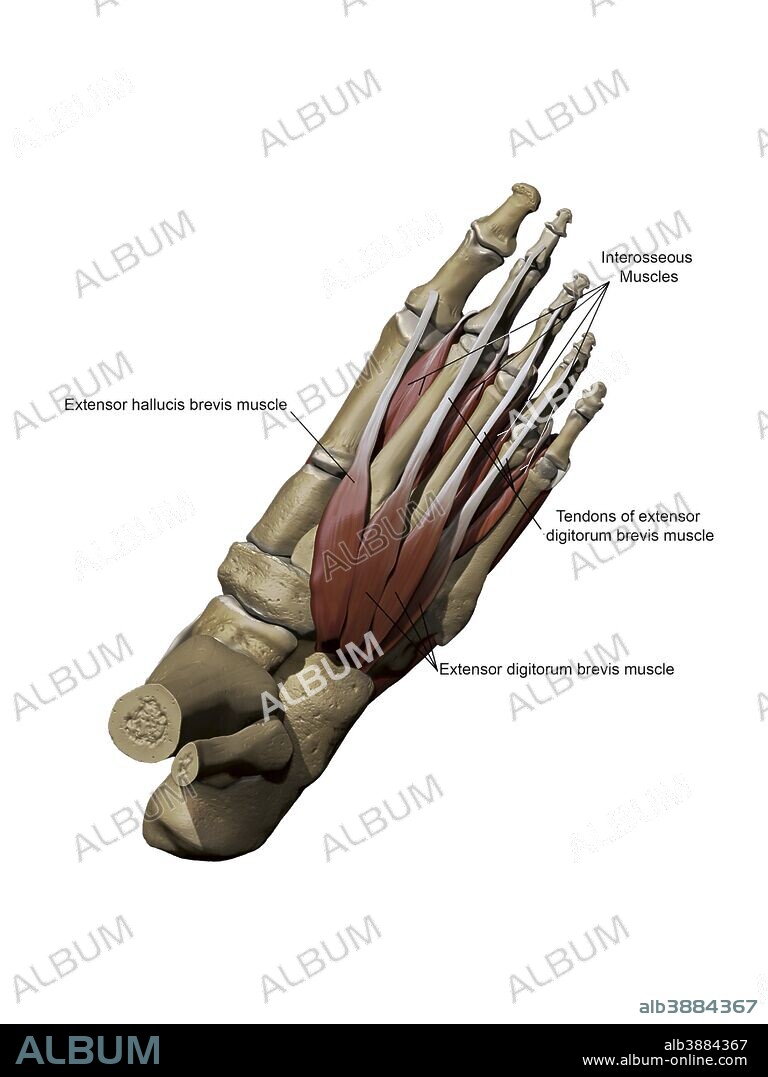 3D model of the foot depicting the dorsal intermediate muscles and bone structures with annotations.