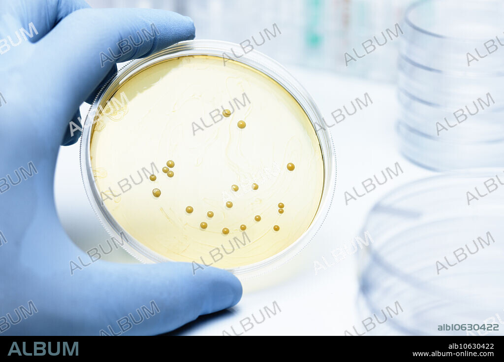 Lactobacillus bacteria colonies