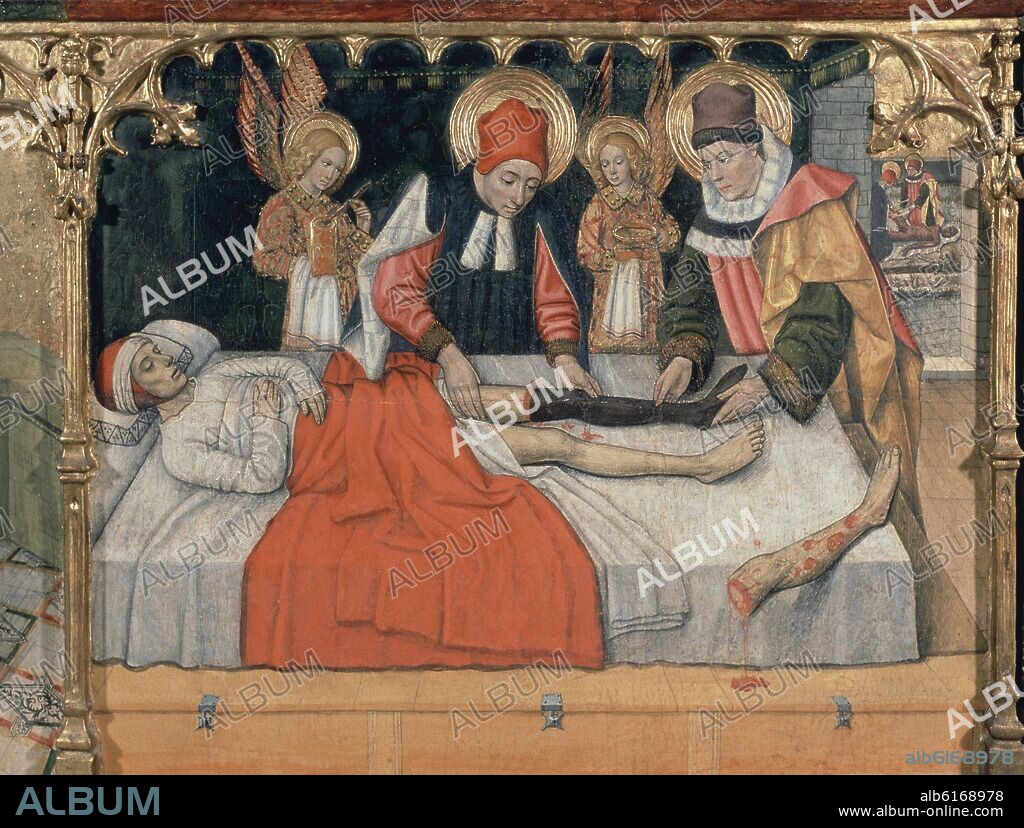 JAIME HUGUET (1414-1492). SAN COSME Y SAN DAMIÁN.RETABLO DE LOS SANTOS SAN ABDON Y SENEN - DETALLE - OPERACION DE UN EMPALME DE PIERNA DE UN ETIOPE - SIGLO XV.