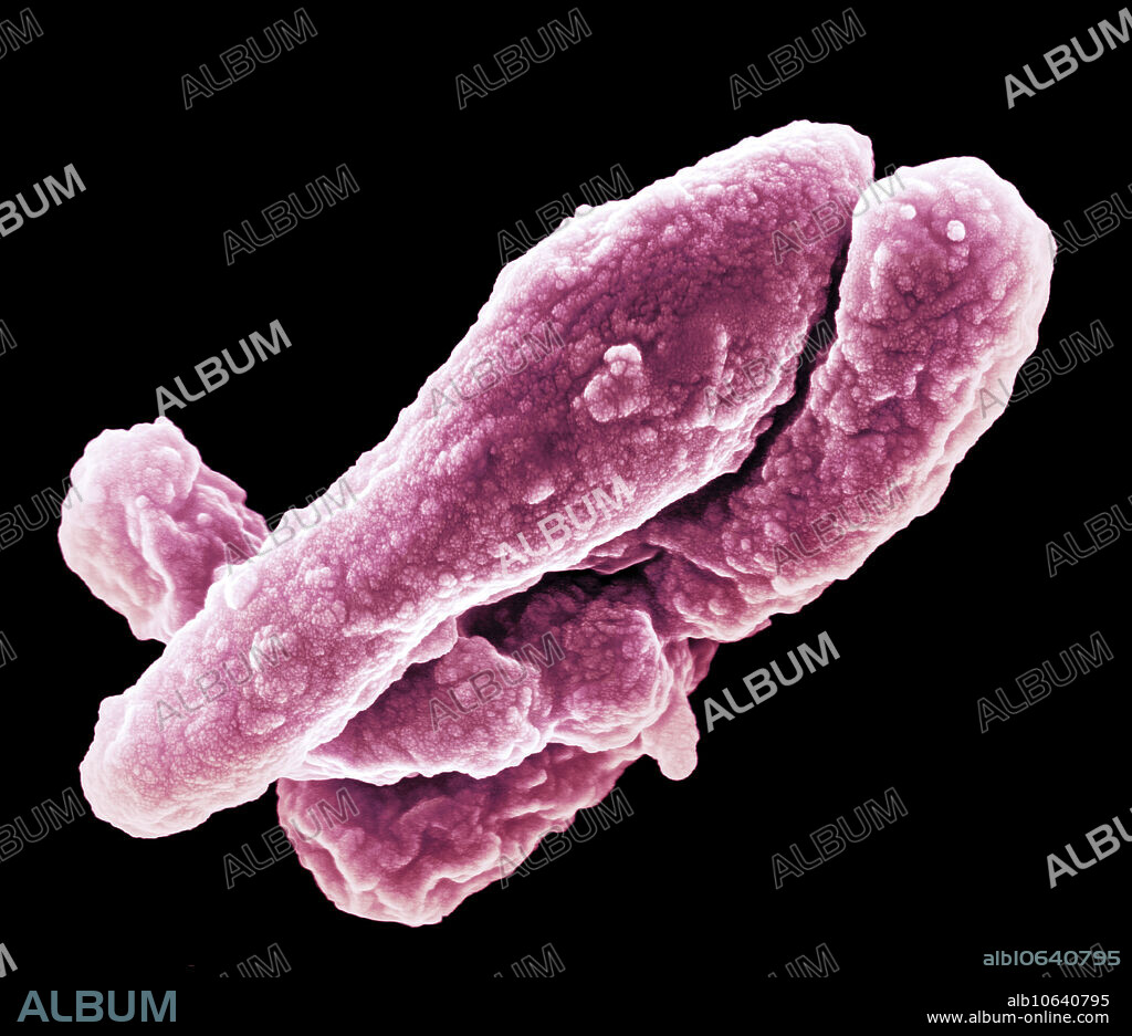 Scanning electron micrograph (SEM) of Bacillus and Clostridium. The gram-positive spore-forming bacilli are the Bacillus and Clostridium species. These bacilli are ubiquitous, and because they form spores, they can survive in the environment for many years. Whereas the Bacillus species are aerobes, the Clostridium species are anaerobes. Clostridium is a genus of Gram-positive bacteria, which includes several significant human pathogens, including the causative agent of botulism and diarrhoea. Clostridium species inhabit soils and the intestinal tract of animals, including humans. It is also a normal inhabitant of the healthy lower reproductive tract of women. Magnification is 35,000x at 15 cm image size.