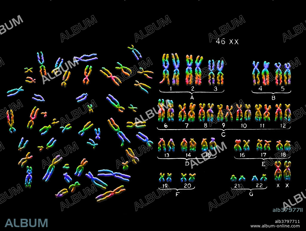 Colour enhanced micrograph of a karyotype of full complement (22 pairs + XX) of normal, female (human) chromosomes. The standard human karyotype shows 22 pairs of autosomal chromosomes and one pair of sex chromosomes (female: 46, XX, male: 46, XY).