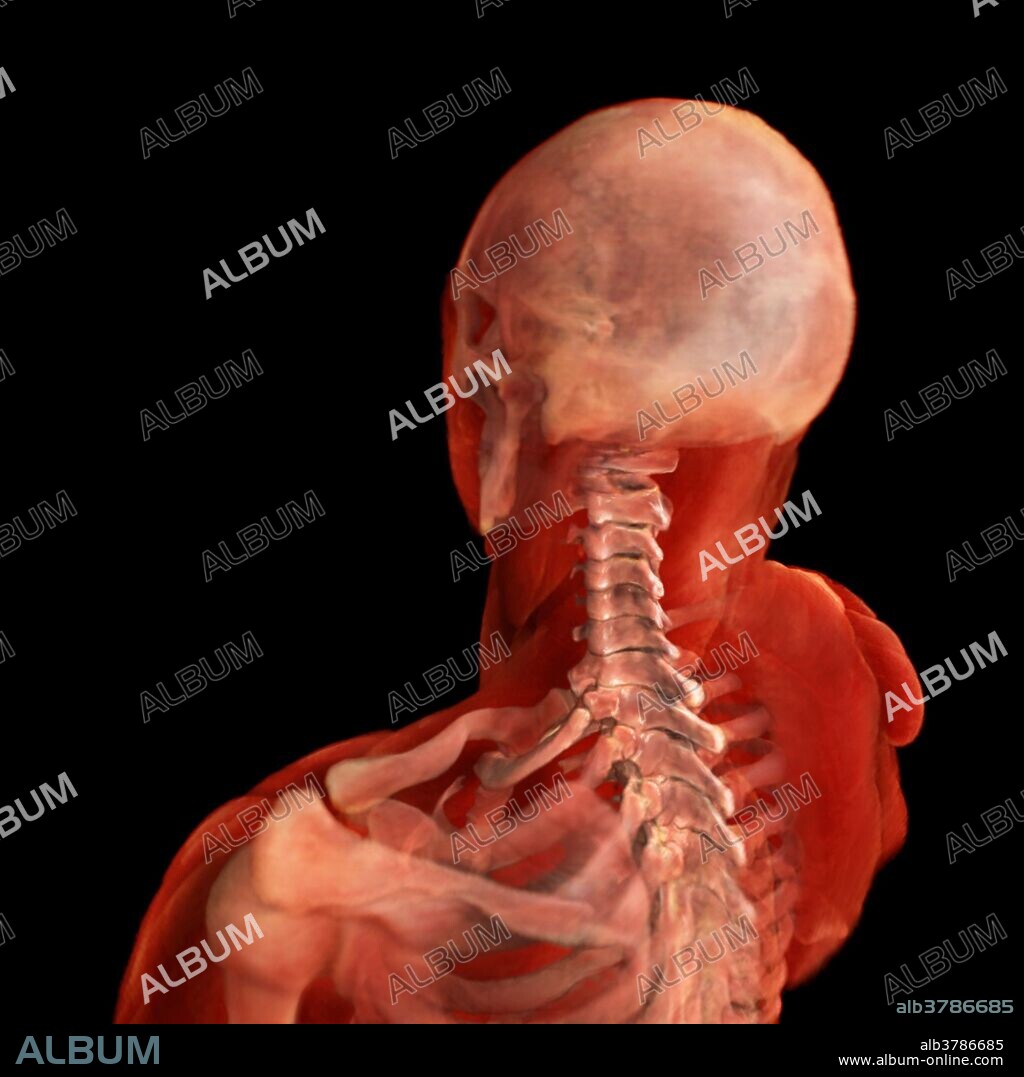 3D visualization based on scanned human data of posterolateral view of the cervical spine. The cervical spine consist of 7 vertebrae - C1-C7. The movements of the cervical spine are flexion and extension of the head which predominantly take place between the first cervical spine and the occipital bone of the skull. Rotation of the head occurs entirely at the joint between the first and second cervical vertebrae, the atlanto-axial joint.