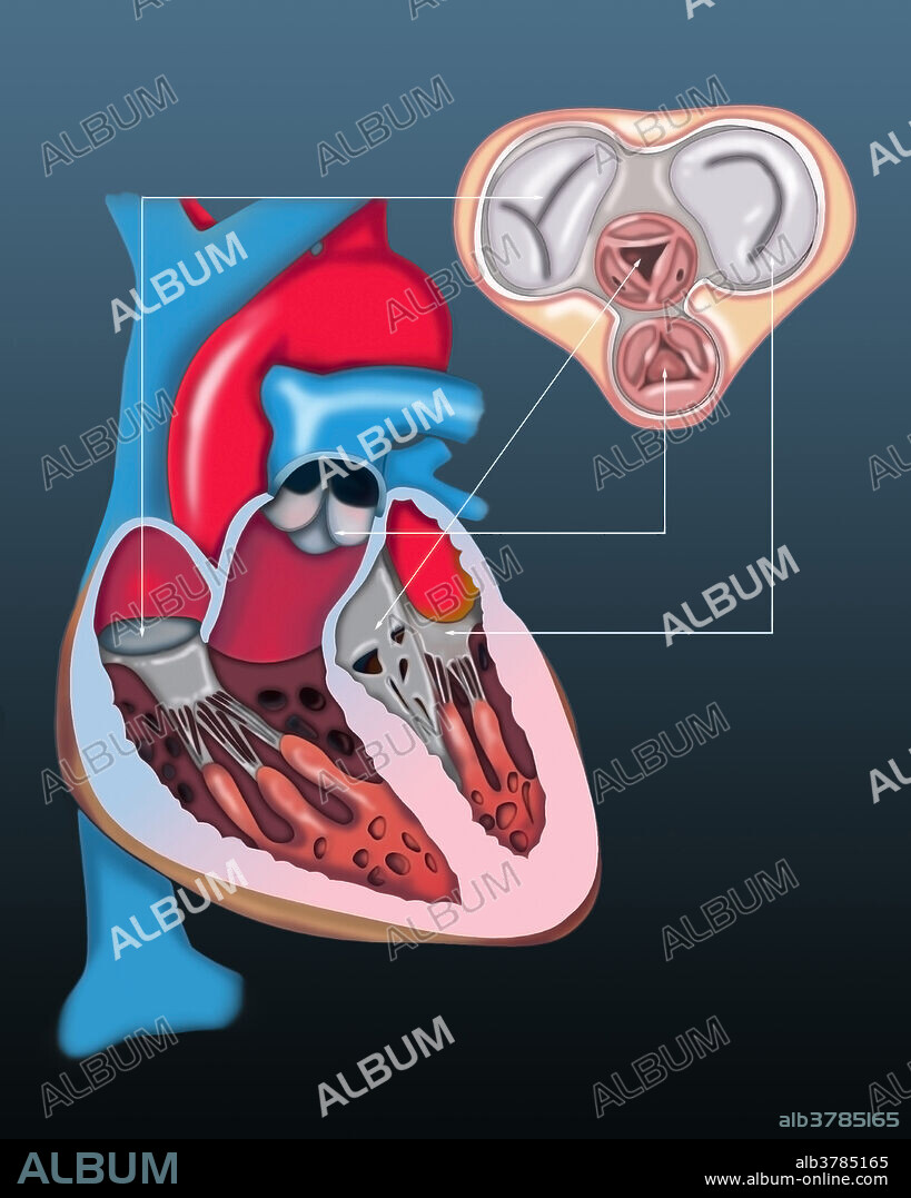 Medical illustration of a cross-section orientation of the heart and major vessels linked to an overhead view of the four heart valves.